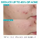 EFFACLAR ACNE TREATMENT LA ROCHE-POSAY 45G