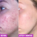 GOOD MOLECULES BHA CLARIFY GEL CREAM