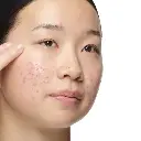 THE ORDINARY ALOE 2%+NAG 2% 30ML