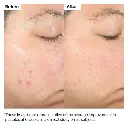 THE ORDINARY  SALICILYC ACID 2% 30ML