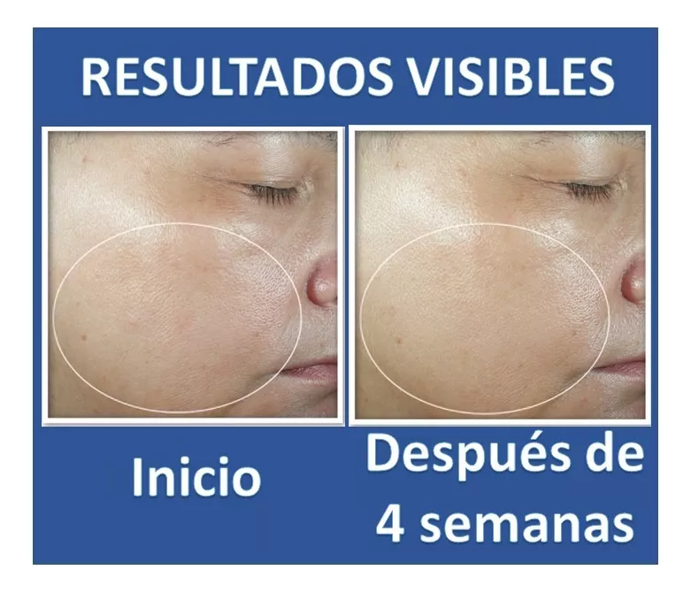 ROC RESURFACING SERUM