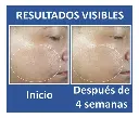 ROC RESURFACING SERUM