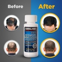 MINOXIDIL HAIR REGROWTH TREATMENT 360ML