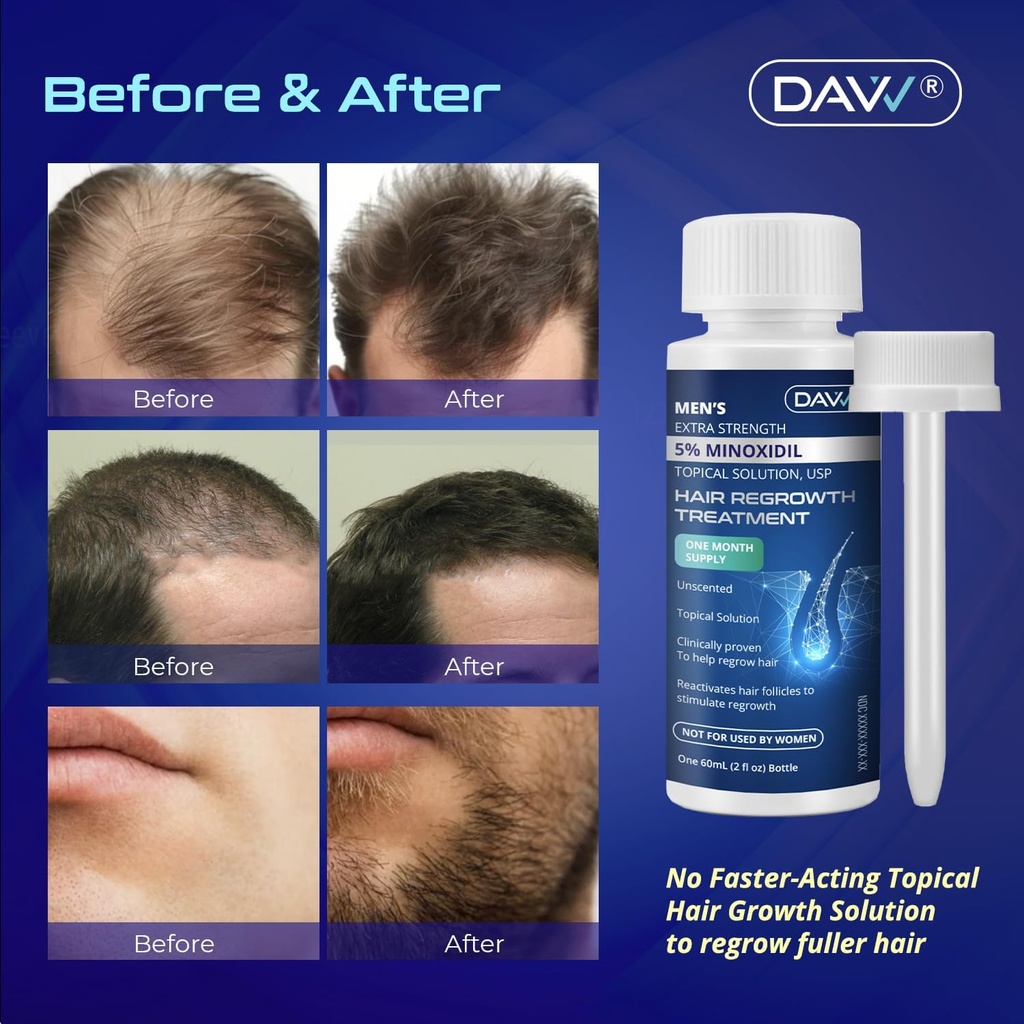 MINOXIDIL HAIR REGROWTH TREATMENT 60ML