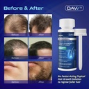 MINOXIDIL HAIR REGROWTH TREATMENT 60ML